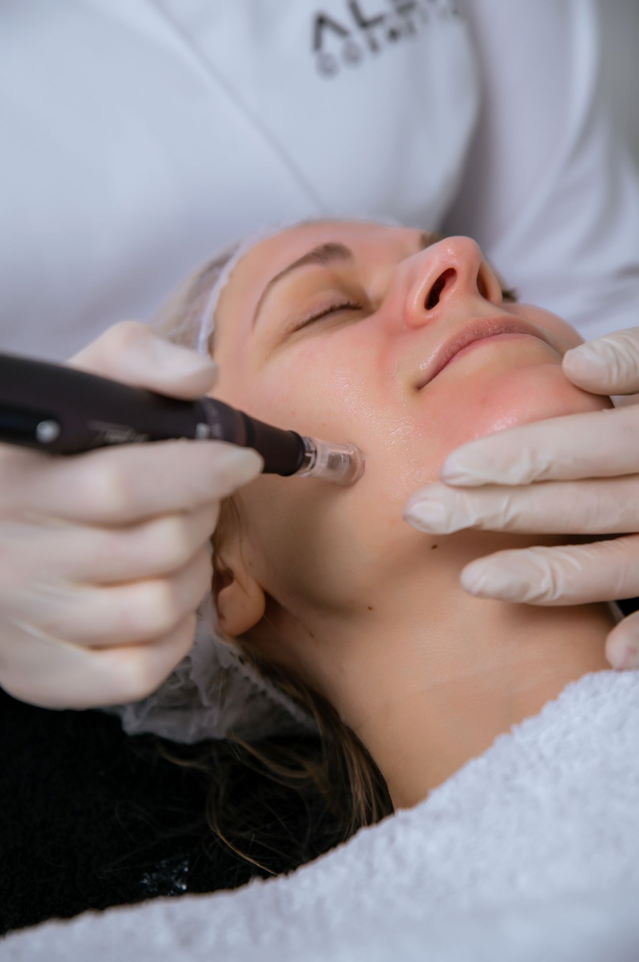 Gezielte Microneedling Behandlung mit Dermapen – sichtbar glattere Haut Microneedling Behandlung in Fellbach – Kosmetikerin mit Dermapen zur Hautverjüngung