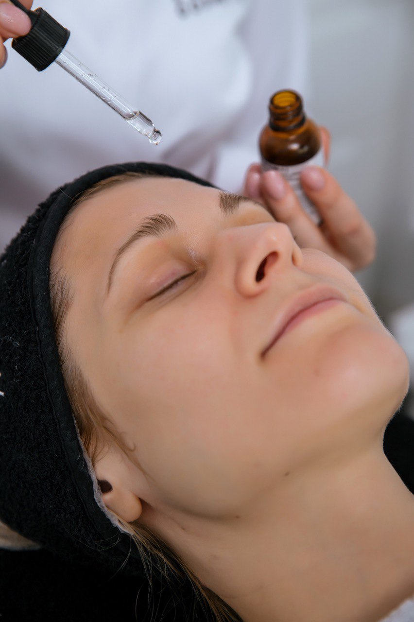 Microneedling mit Säurepeeling - doppelte Power für makellos glatte Haut Microneedling mit Säurepeeling - doppelte Power für makellos glatte Haut